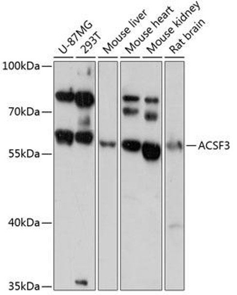 Anti-ACSF3 Antibody (CAB13769)