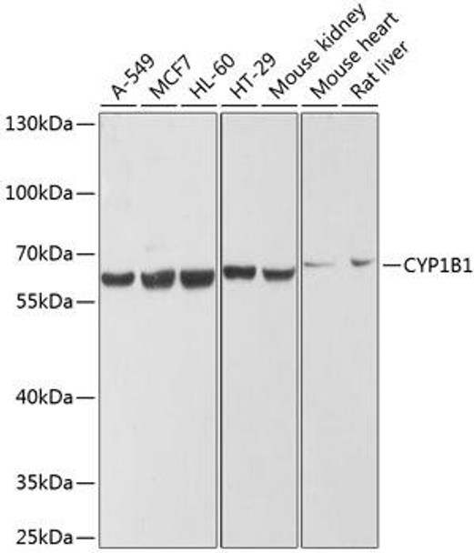 Anti-CYP1B1 Antibody (CAB1377)
