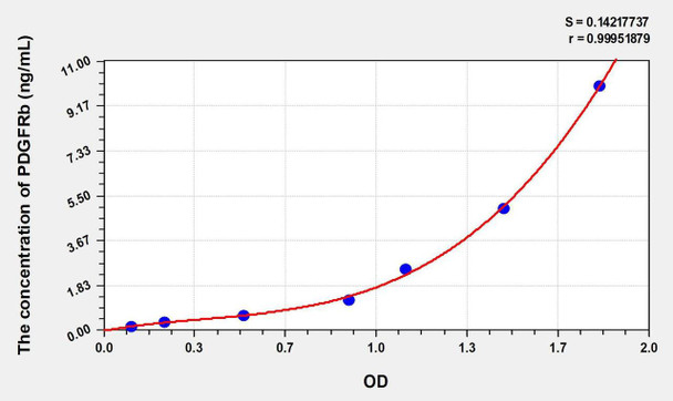 Human PDGFRb (Platelet Derived Growth Factor Receptor Beta) ELISA Kit (AEKE00474)