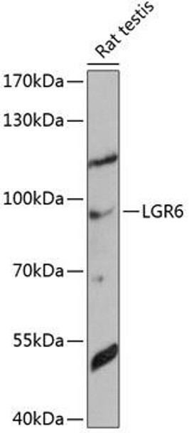 Anti-LGR6 Antibody (CAB14173)