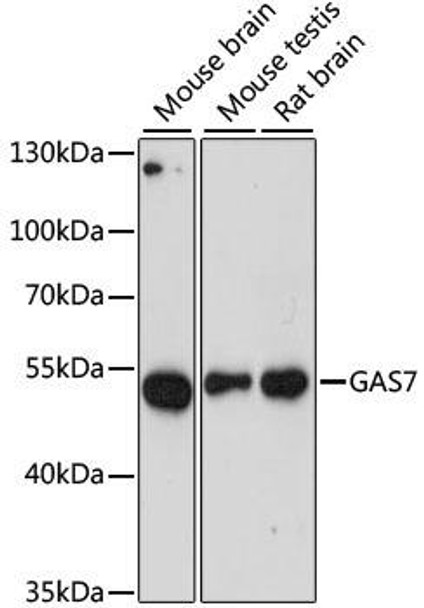 Anti-GAS7 Antibody (CAB14179)
