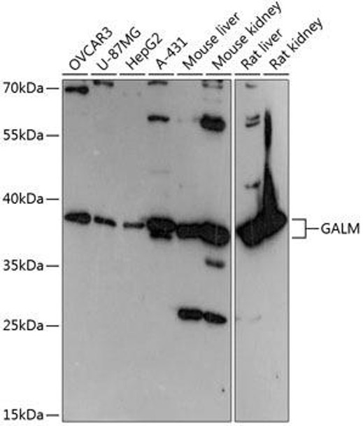 Anti-GALM Antibody (CAB14362)