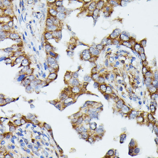 Anti-MTIF2 Antibody (CAB16402)