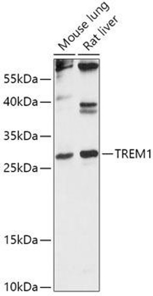 Anti-TREM1 Antibody (CAB16535)