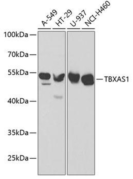 Anti-TBXAS1 Antibody (CAB1988)