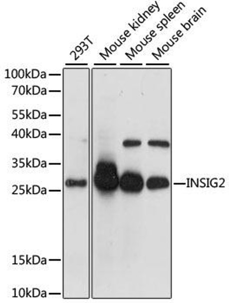 Anti-INSIG2 Antibody (CAB1992)