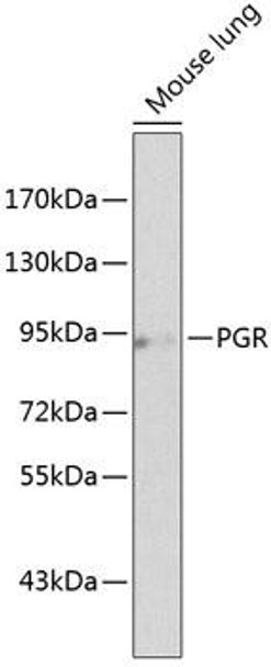 Anti-PGR Antibody (CAB2105)