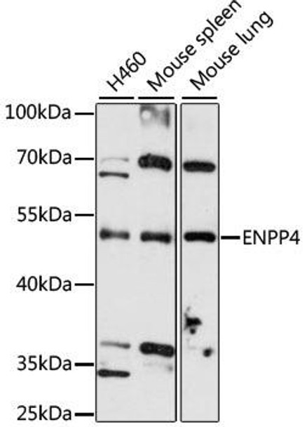 Anti-ENPP4 Antibody (CAB4516)