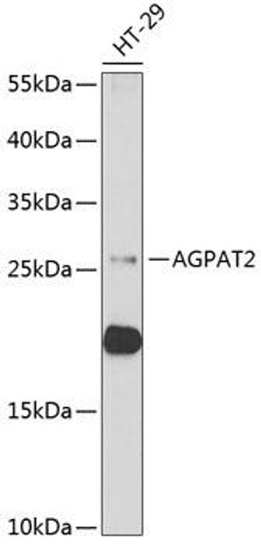 Anti-AGPAT2 Antibody (CAB6518)