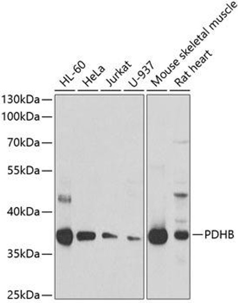 Anti-PDHB Antibody (CAB6943)