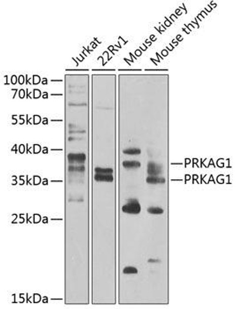 Anti-PRKAG1 Antibody (CAB7300)