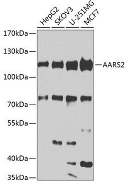 Anti-AARS2 Antibody (CAB7826)