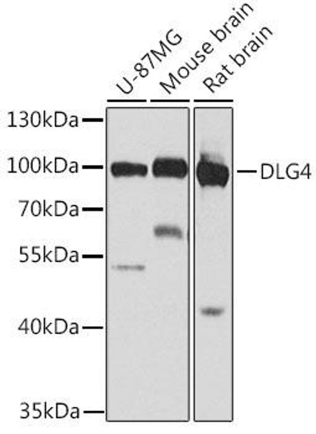 Anti-DLG4 Antibody (CAB7889)