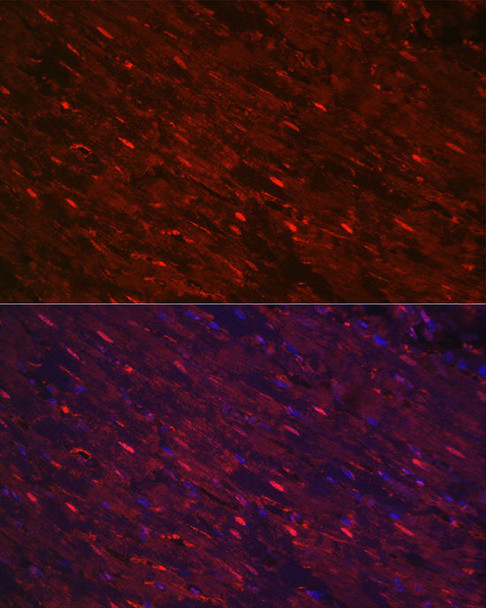 Anti-PGAM2 Antibody (CAB7917)