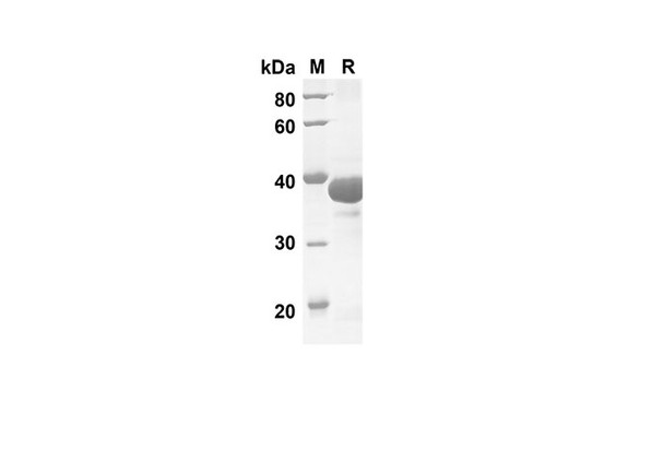 Recombinant Human IL17D Protein(Sumo Tag) (RPES8005)
