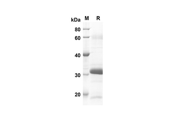 Recombinant Human BMP-2 Protein(Sumo Tag) (RPES8014)