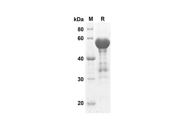 Recombinant Human ACE2 Protein(Trx Tag) (RPES8016)