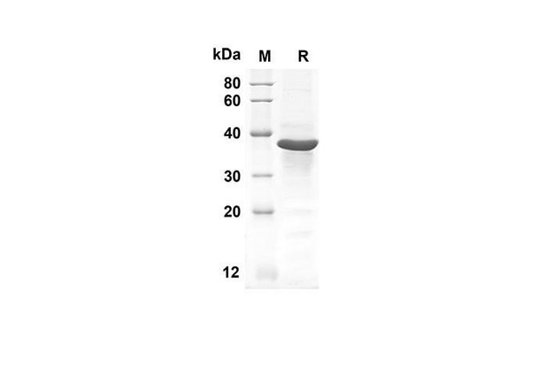 Recombinant Human GLI1 Protein(Trx Tag) (RPES8025)