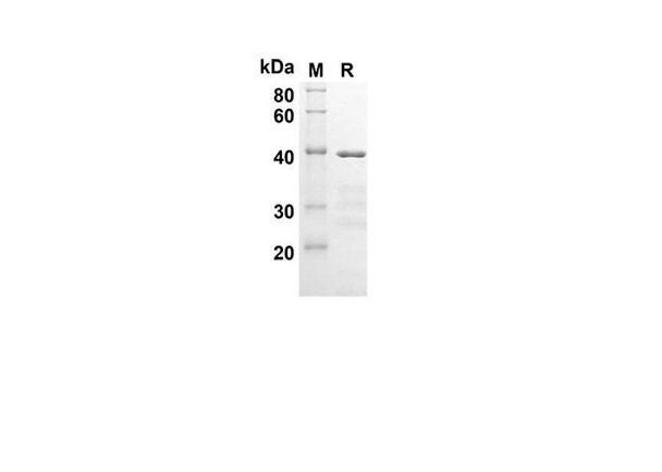 Recombinant Human BCL2 Protein(Trx Tag) (RPES8049)