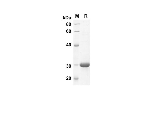 Recombinant Human S100A1 Protein(Sumo Tag) (RPES8067)