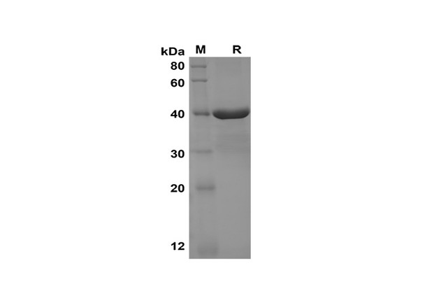 Recombinant Human NUCB2 Protein(Gst Tag) (RPES8090)
