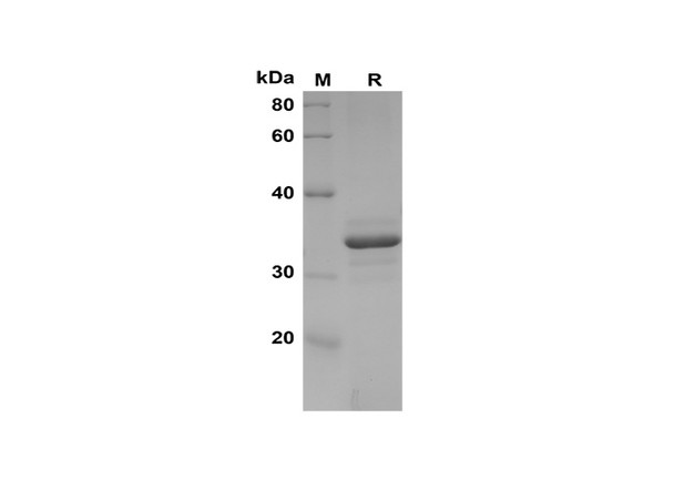 Recombinant Human NOX5 Protein(Sumo Tag) (RPES8093)
