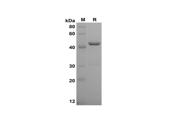 Recombinant Human TNF-Â± Protein(Gst Tag) (RPES8100)