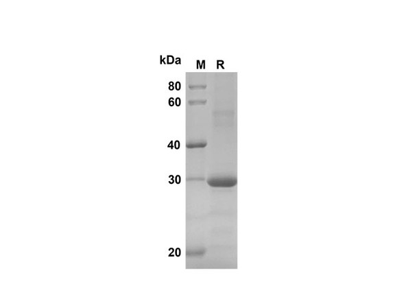 Recombinant Human CXCL3/CINC-2Î±/Î² Protein(Trx Tag) (RPES8104)