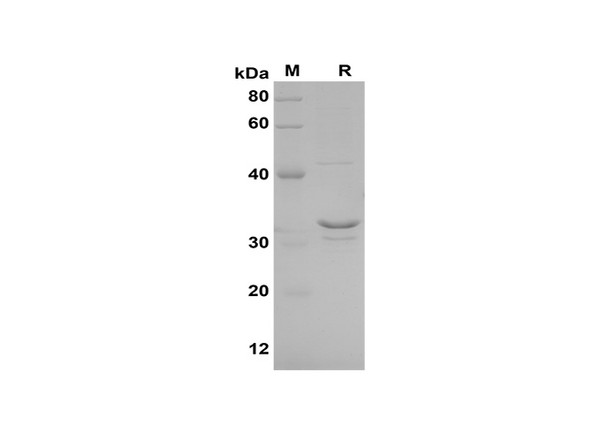 Recombinant Human XCL1/Lymphotactin Protein(Trx Tag) (RPES8108)