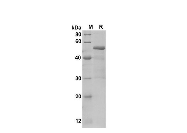 Recombinant Human IL-17D Protein(Gst Tag) (RPES8109)