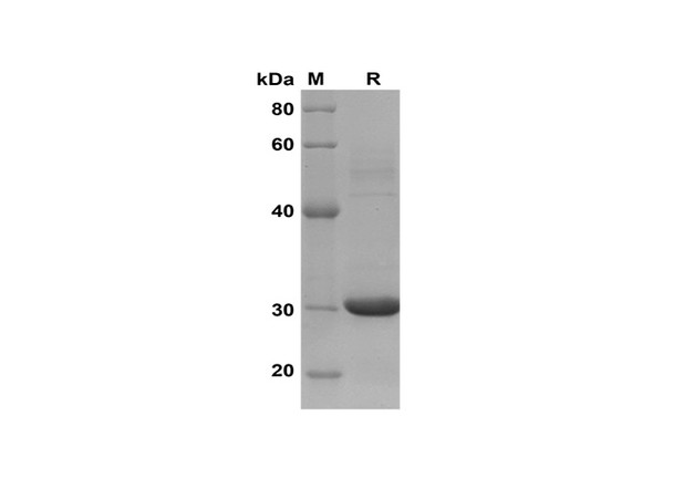Recombinant Human CCL18/PARC Protein(Trx Tag) (RPES8114)