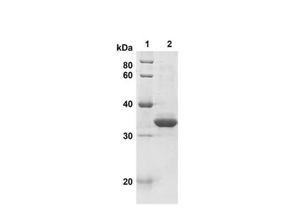Recombinant Human AIF1 Protein(Trx Tag) (RPES8115)
