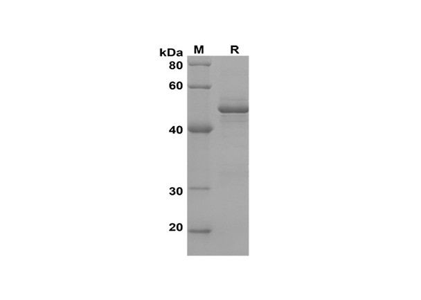 Recombinant Human STAR Protein(Trx Tag) (RPES8120)