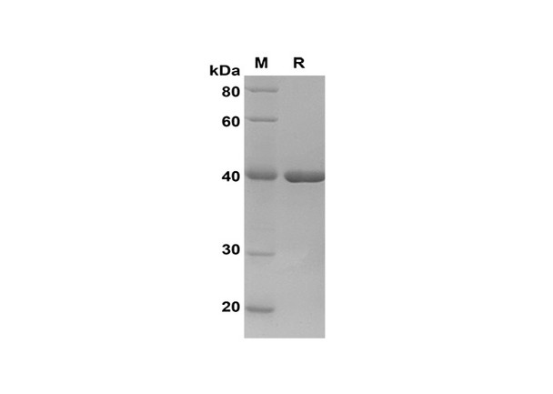 Recombinant Human STAT3 APRF Protein(Sumo Tag) (RPES8126)