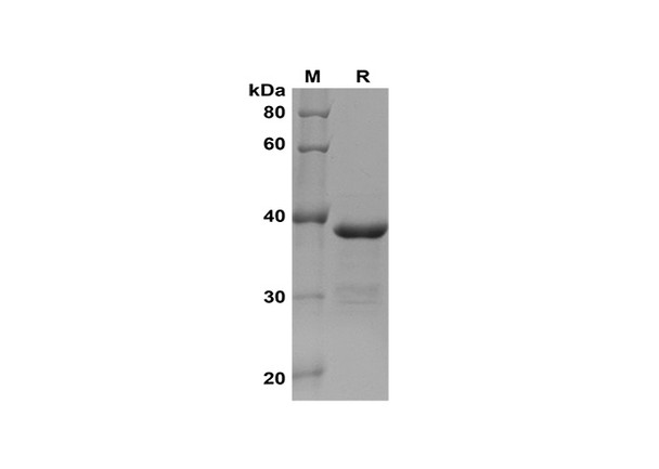 Recombinant Human ABCG2 Protein(Gst Tag) (RPES8139)