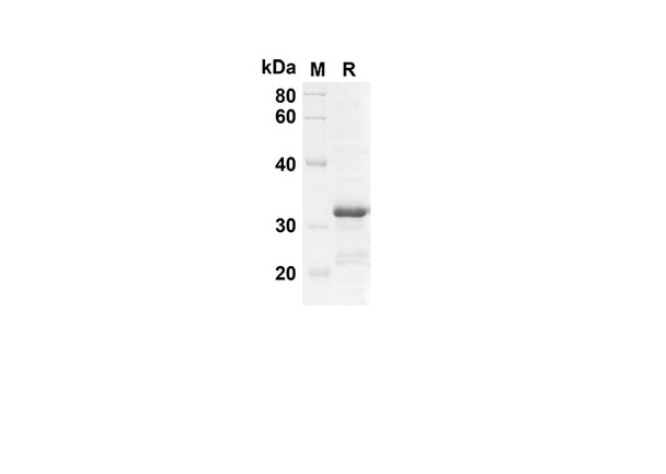 Recombinant Mouse Ccl22 Protein(TRX Tag) (RPES8144)