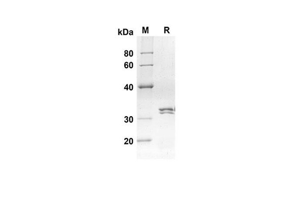 Recombinant Mouse Ccl24 Protein(Trx Tag) (RPES8154)