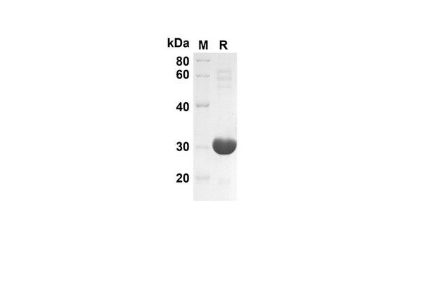 Recombinant Mouse CXCL2 Protein(Trx Tag) (RPES8164)
