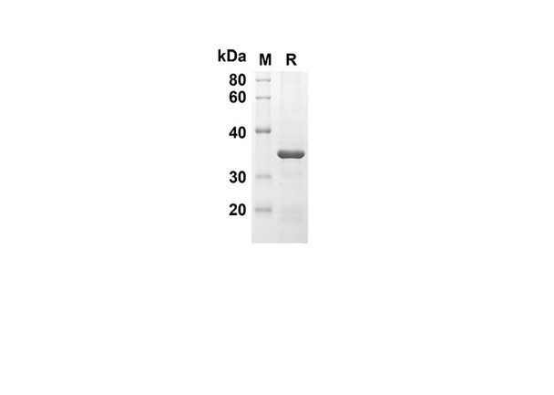Recombinant Mouse IFNA2 Protein(Trx Tag) (RPES8166)