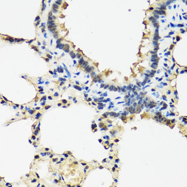 Anti-Arylsulfatase F Antibody (CAB8102)