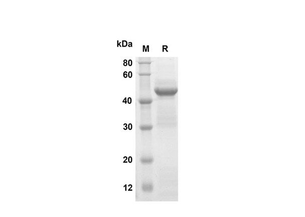Recombinant Mouse Galectin-7 Protein(Gst Tag) (RPES8184)