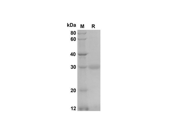 Recombinant Mouse CXCL3/CINC-2Â±/Â² Protein(Trx Tag) (RPES8190)