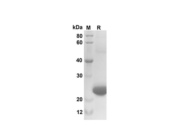 Recombinant Mouse CXCL3/CINC-2Î±/Î² Protein(Sumo Tag) (RPES8191)