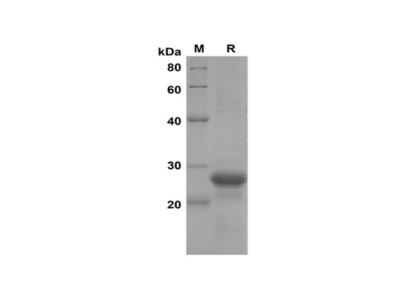 Recombinant Mouse CXCL2/MIP-2 Protein(Sumo Tag) (RPES8192)