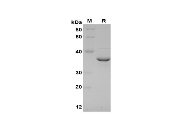 Recombinant Mouse IL-17C Protein(Sumo Tag) (RPES8194)