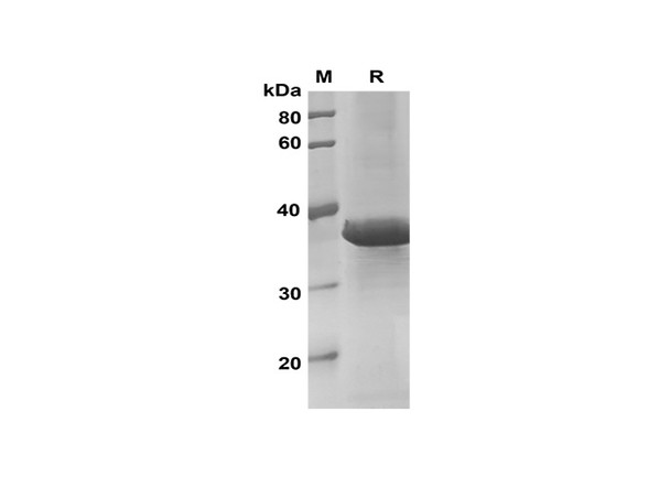 Recombinant Mouse IL-17D Protein(Trx Tag) (RPES8196)
