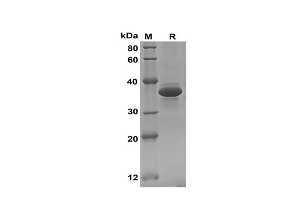 Recombinant Mouse IL-17D Protein(Sumo Tag) (RPES8197)