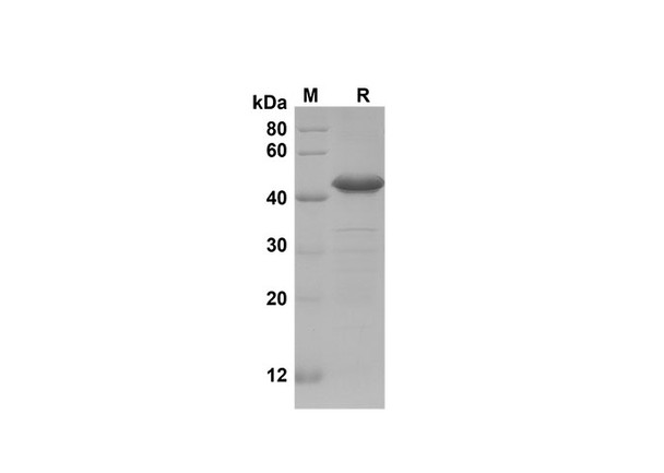 Recombinant Mouse IGFBP-1 Protein(Sumo Tag) (RPES8214)