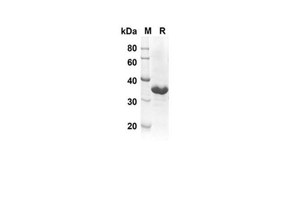 Recombinant Rat IL-21 Protein(Trx Tag) (RPES8224)