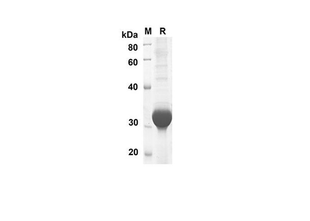 Recombinant Rat GAL1 Protein(Trx Tag) (RPES8235)